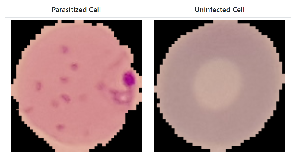 Deep Learning: Malaria Detection using CNN Model in TensorFlow & Keras